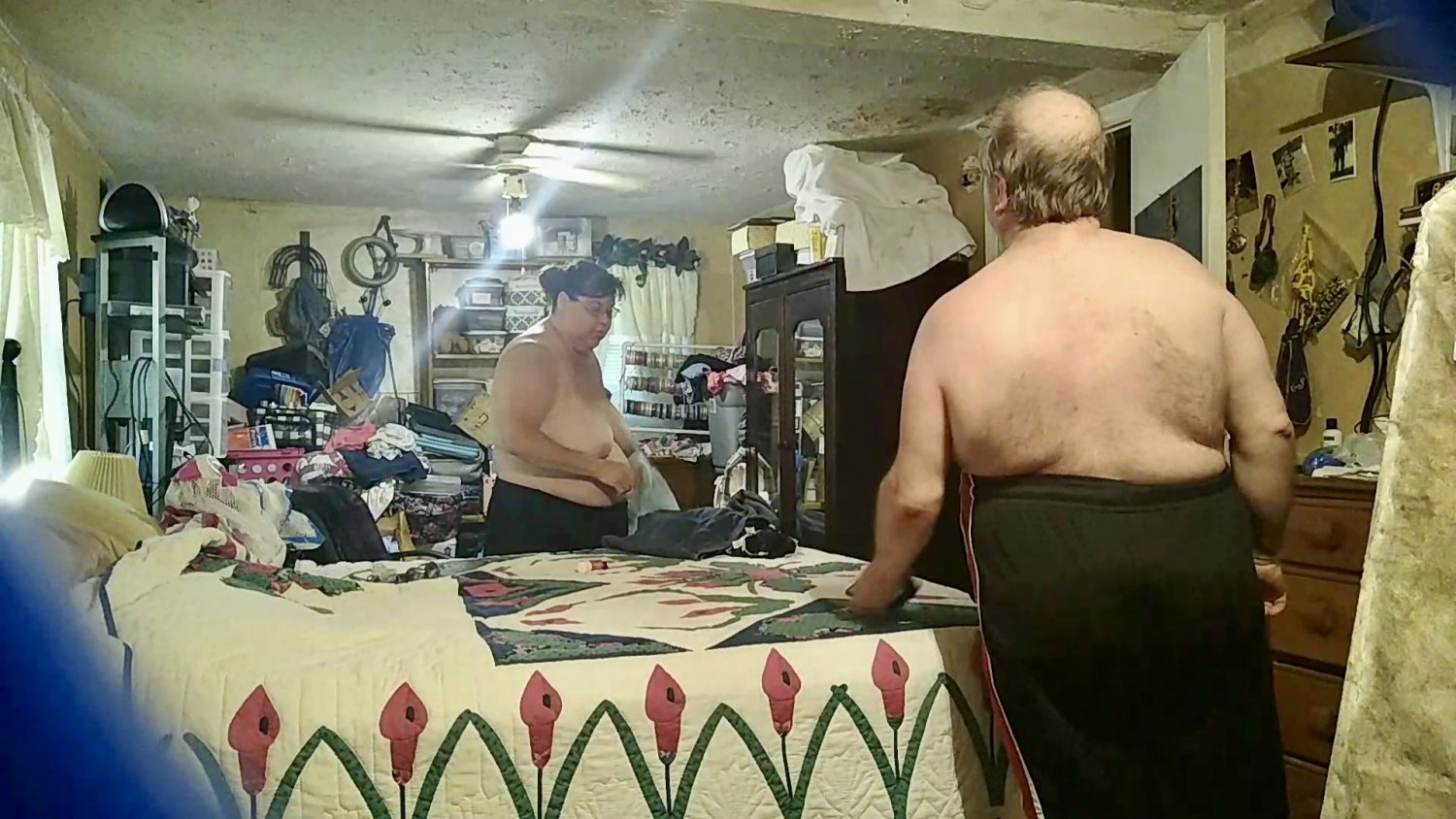 Sexy amputee bbw getting ready for the lake. #aWQgxwuf